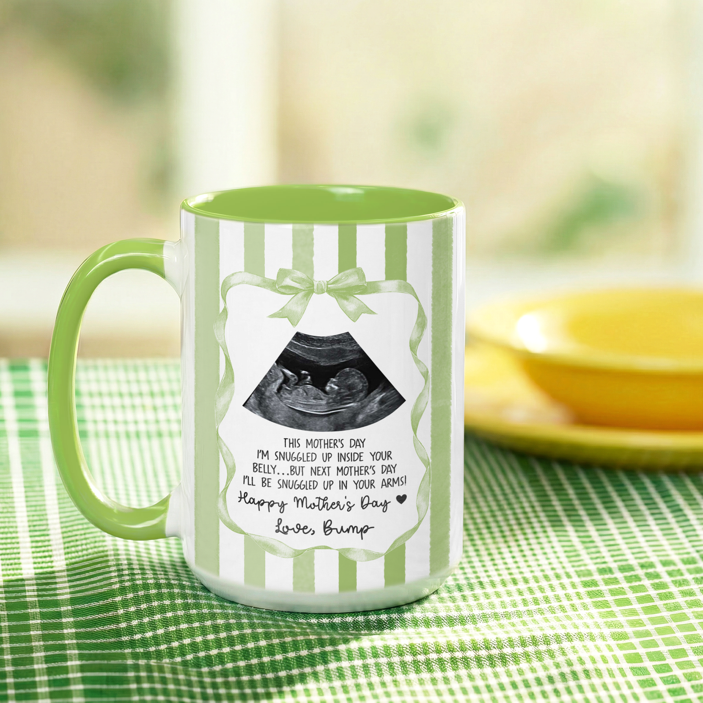 Personalized Ultrasound Mug for Mom – First Mother’s Day Gift from Baby Bump