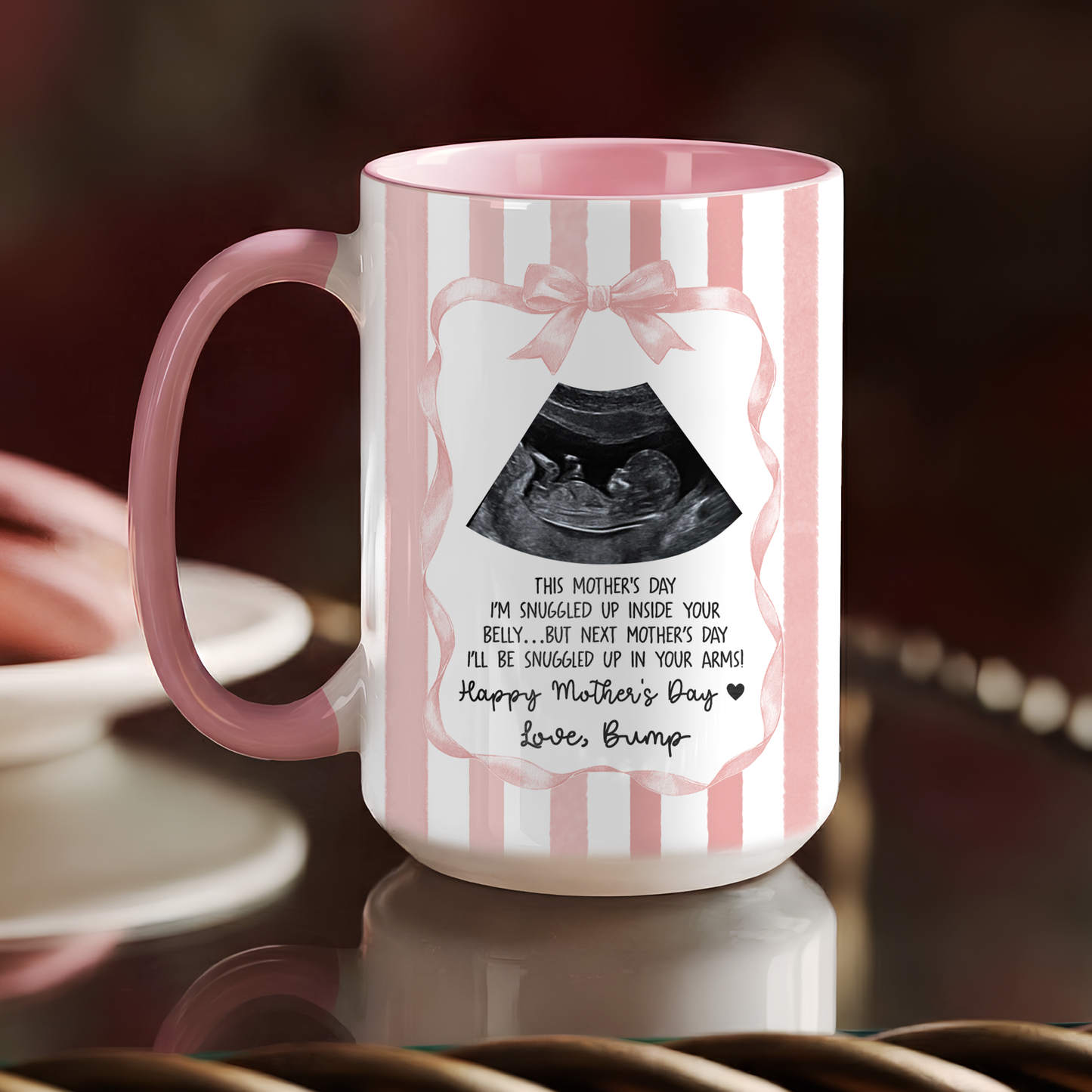Personalized Ultrasound Mug for Mom – First Mother’s Day Gift from Baby Bump
