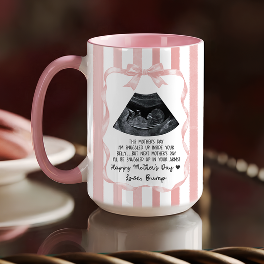 Personalized Ultrasound Mug for Mom – First Mother’s Day Gift from Baby Bump