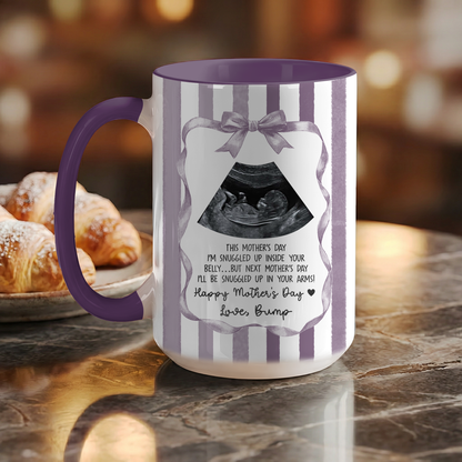 Personalized Ultrasound Mug for Mom – First Mother’s Day Gift from Baby Bump